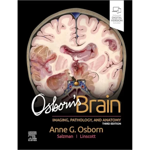 Osborn’s Brain: Imaging, Pathology, and Anatomy 3e