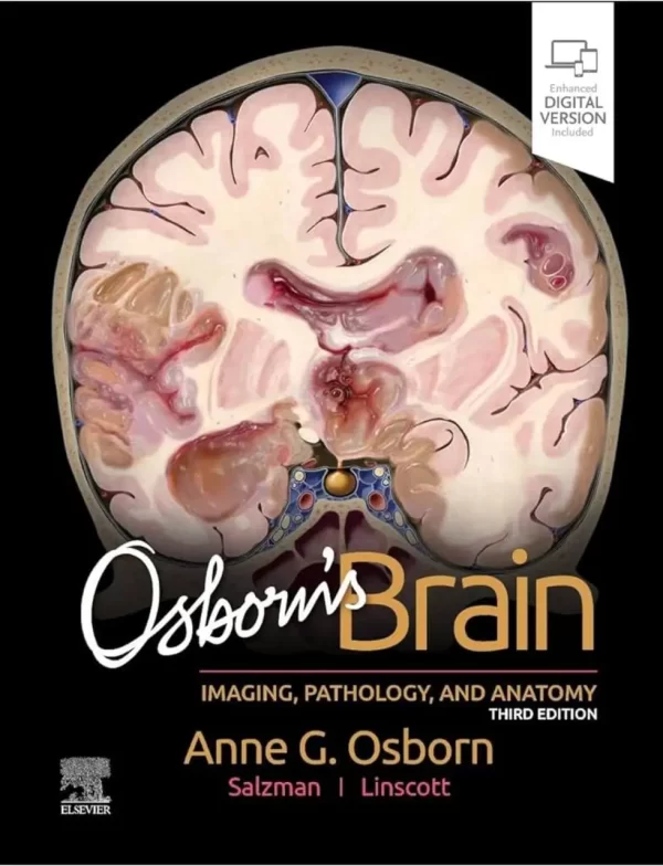 Osborn’s Brain: Imaging, Pathology, and Anatomy 3e