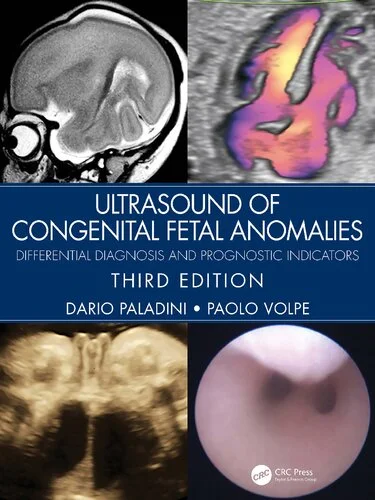 Ultrasound Of Congenital Fetal Anomalies: Differential Diagnosis And Prognostic Indicators, 3ra edición (PDF original)