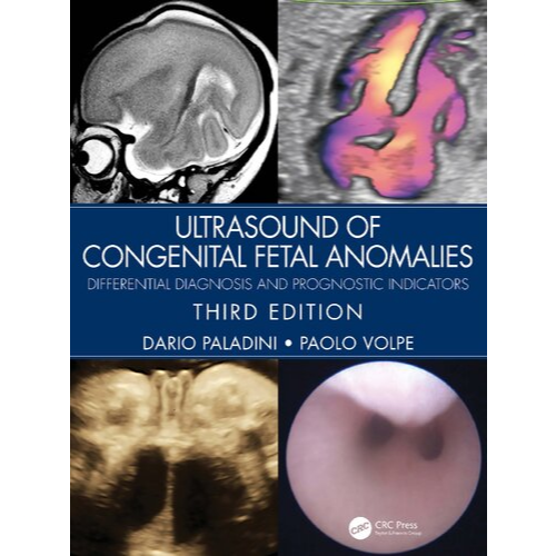 Ultrasound Of Congenital Fetal Anomalies: Differential Diagnosis And Prognostic Indicators, 3ra edición (PDF original)